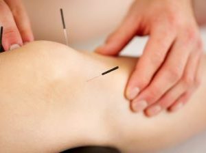 Acupuncture Joint & Back Pain Chiro Continuing Ed