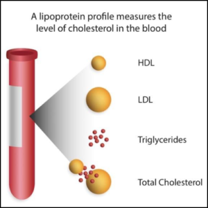 Figure 10 Lipoprotein Profile