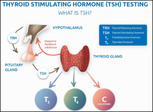 Figure 15 Thyroid Stimulating Hormone Test