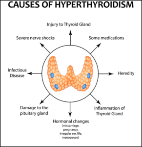 Figure 16 Causes of Hyperthyroidism